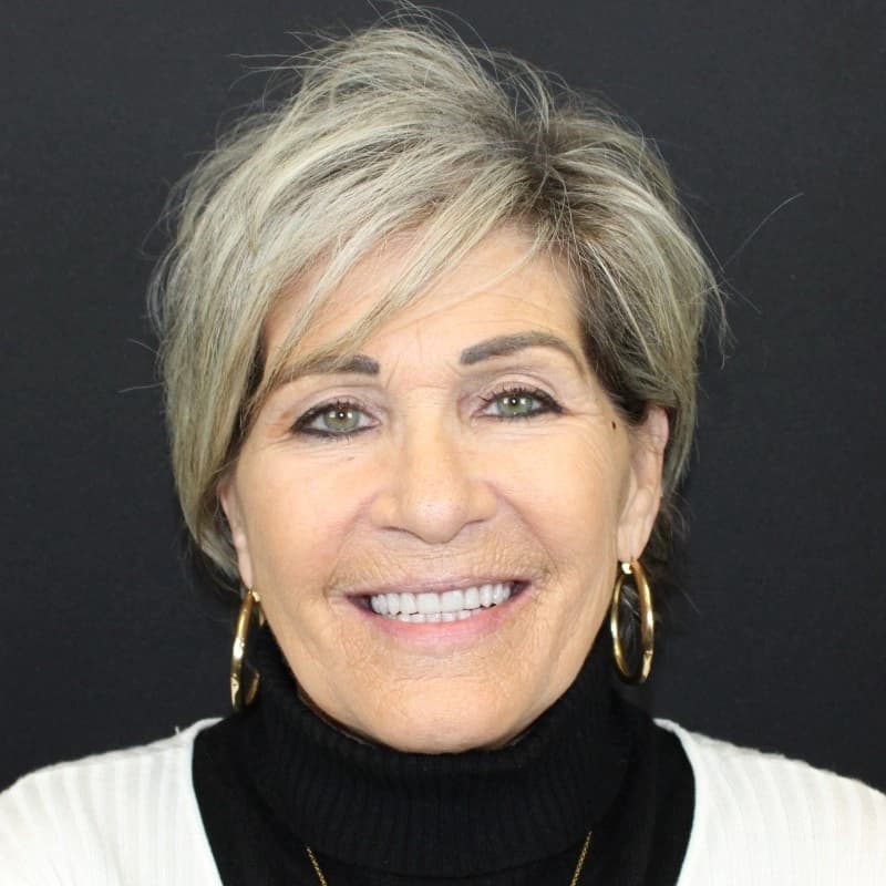 Pamela after treatment