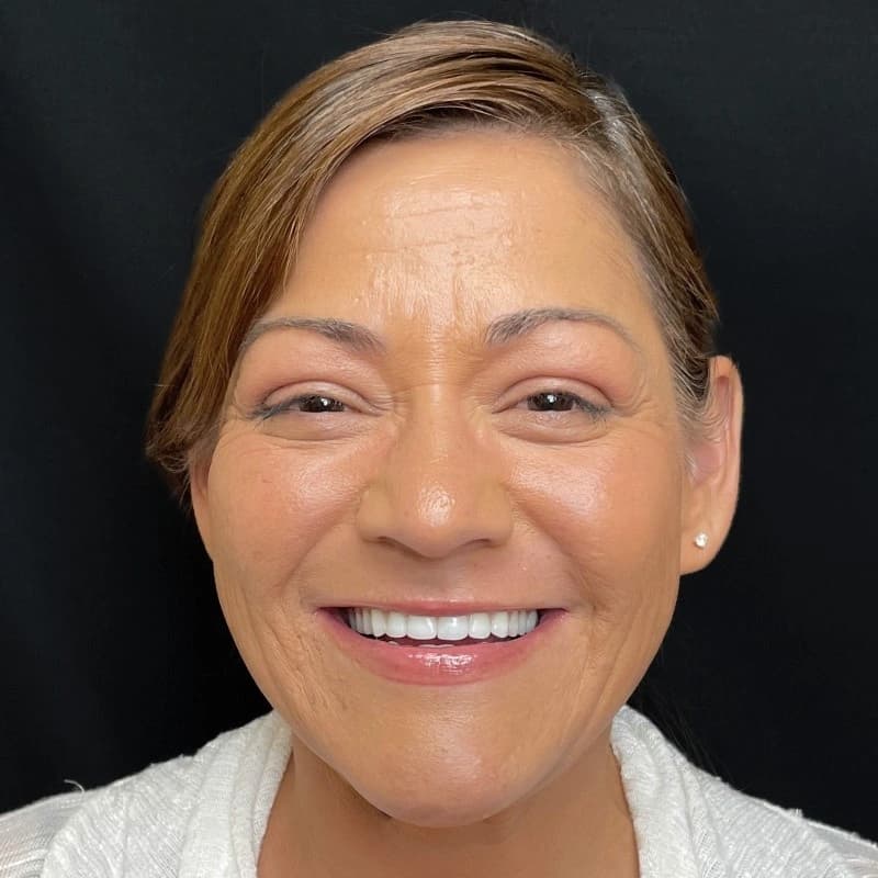 Vanessa after treatment